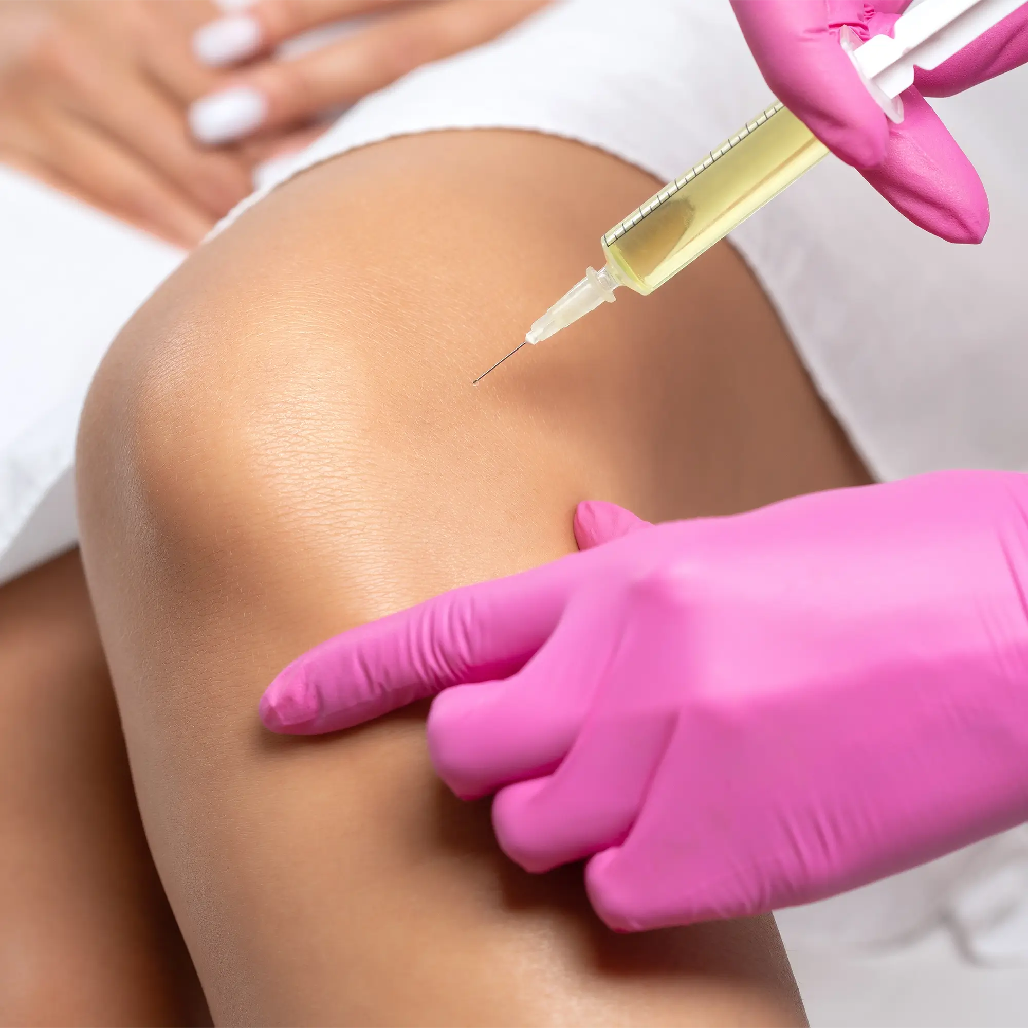 Clinician wearing pink gloves preparing to inject around a patient’s knee during regenerative medicine treatment 